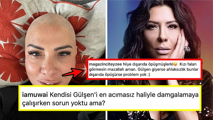 Rahatsızlığı Nedeniyle Saçlarını Kaybeden Işın Karaca'ya Gelen Çirkin Yorum Sonrası Ortalık Fena Karıştı!