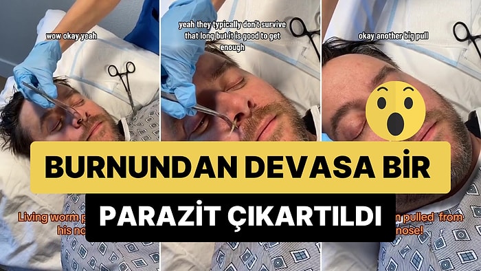 Burnundan Devasa Bir Parazit Çıkartılan Adamın İzleyenleri Şoke Eden Görüntüleri