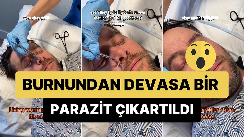 Burnundan Devasa Bir Parazit Çıkartılan Adamın İzleyenleri Şoke Eden Görüntüleri