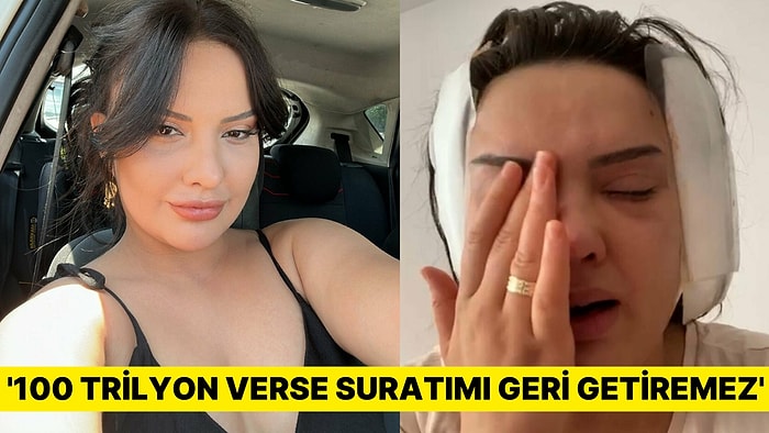 Güzelleşmek İçin Ameliyat Oldu! Hayatının Şokunu Yaşadı: '100 Trilyon Verse Suratımı Geri Getiremez'