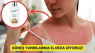 Güneşten Yorulan ve Yanan Cildinizi Rahatlatıp Tedavi Edecek Güneş Sonrası Bakım Ürünleri
