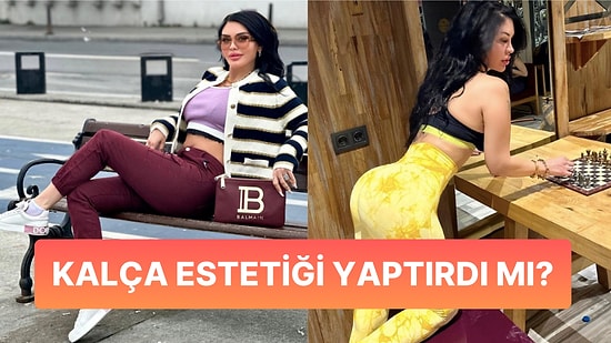İddialı Paylaşımlarıyla Adından Söz Ettiren Ebru Polat'tan Kalça Estetiği İddialarına Yanıt Gecikmedi!