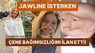 Deneyimsiz Bir Güzellik Uzmanının Kurbanı Olan Kadın, Çene Dolgusu İsterken Az Kalsın Çenesinden Oluyordu!