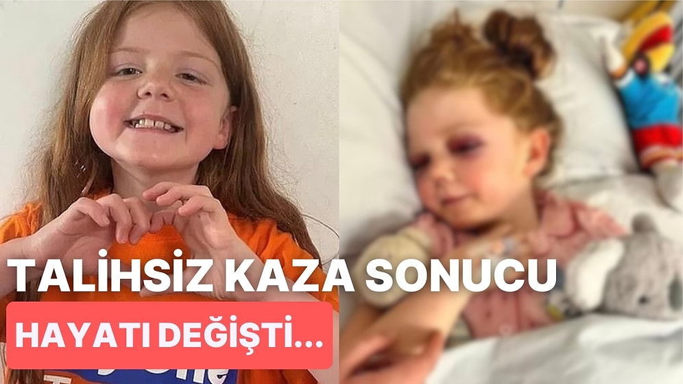 Ailesiyle Tatildeyken Kafasına Top Çarpması Sonucunda Kafatasında 15 Kemiği Kırılan Talihsiz Kız Çocuğu