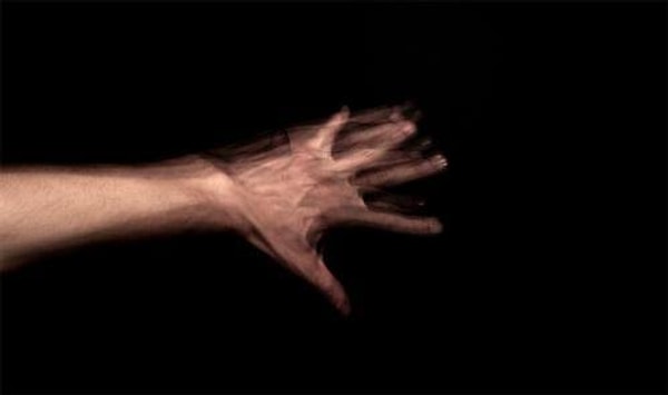 5. "Kesinlikle yabancı el sendromu...Kişinin bir eli kendinden bağımsız bir şekilde hareket ediyor."