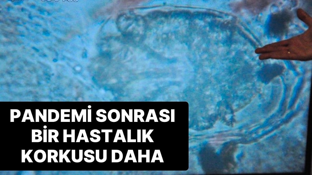 Uyuz Hastalığının Pandemi Sonrası Görülme Oranı Yüzde 50 Arttı