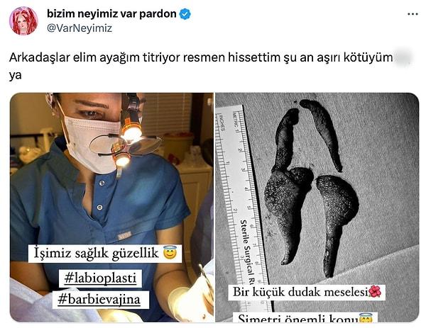 Twitter'da @VarNeyimiz adlı bir kullanıcı, labioplasti işlemi yapan bir doktorun hikayesini paylaştı.