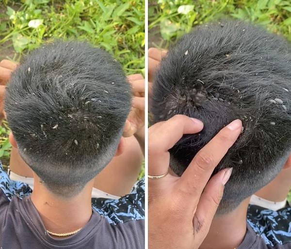 Bir çocuğun, böceklerle sarılmış saçları şaşkınlık yarattı.