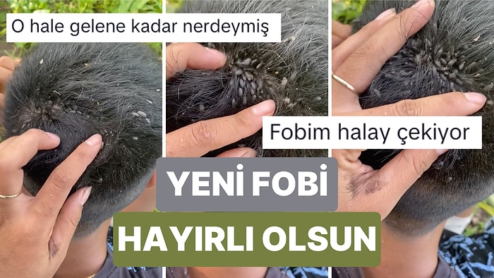 Sosyal Medyada Viral Olan Böceklerle Dolu Saç Videosu İzleyenlerde Yeni Fobiye Sebep Oldu
