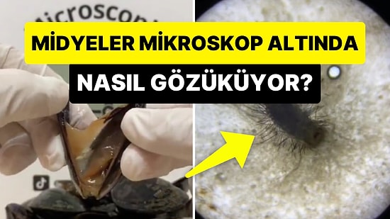 Midye Sevenler Bir Hayli Üzülecek: Midye, Mikroskop Altında Nasıl Gözüküyor?