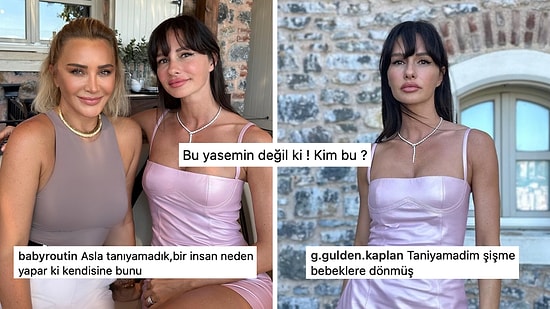 Yasemin Özilhan'ın Son Hali Görenleri Şaşkına Çevirdi: "İsmi Yazmasa Tanıyamazdık!"