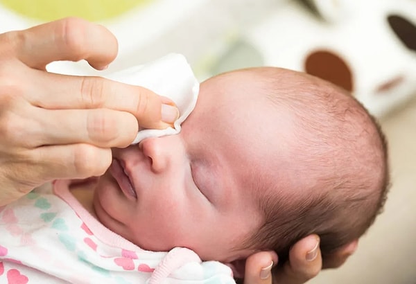 Yine günde 2-3 kere bebeğinizin gözlerini ılık su ile temizlemeniz mümkün. Temizliğe rağmen çapaklanma devam ediyorsa doktorunuzun tavsiyesiyle antibiyotik göz damlası kullanabilirsiniz.