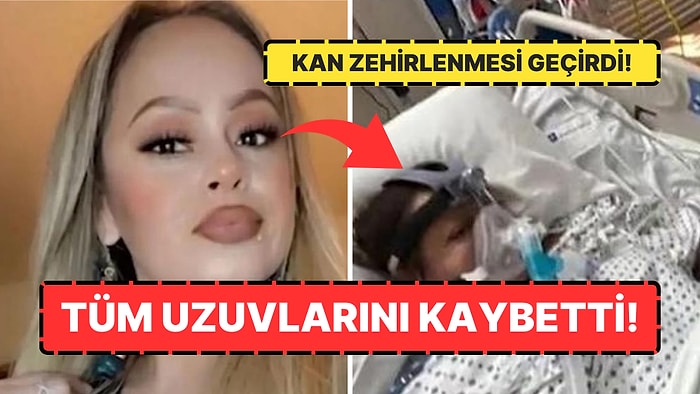 Az Pişmiş Balık Yediği İçin Kolları ve Bacakları Ampute Edilen Kadının Üzücü Hikayesi