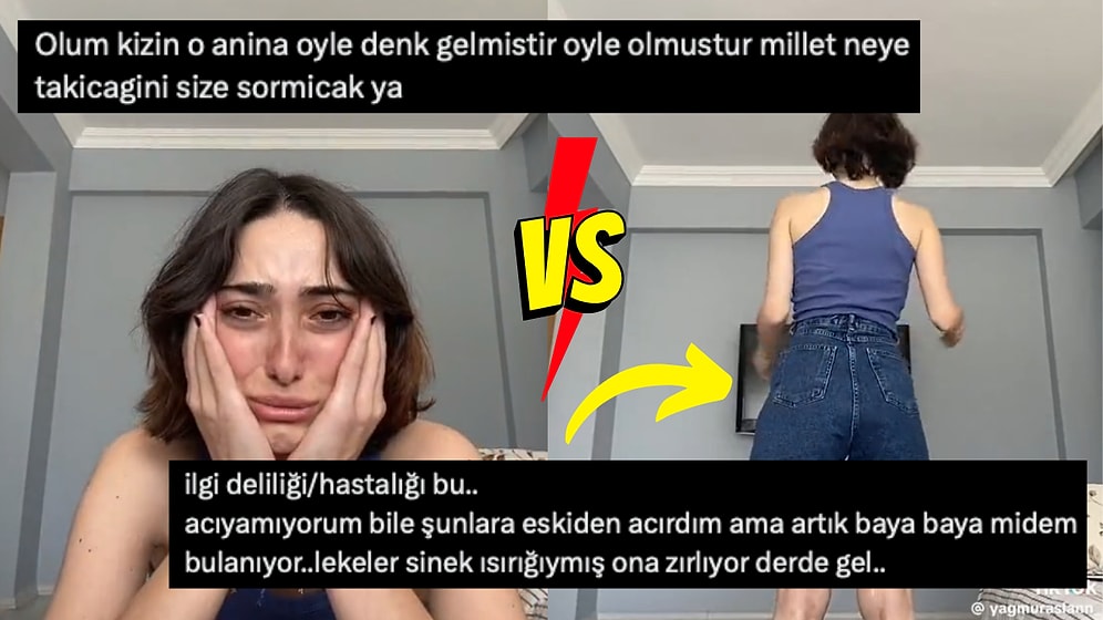 Bacağındaki Sinek Isırıkları Yüzünden İstediği Şortu Giyememekten Dert Yanan Kız, Sosyal Medyayı İkiye Böldü!