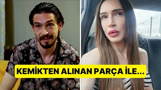 Cinsiyet Geçiş Ameliyatlarının Nasıl Yapıldığını Merak Edenlere Konuyu Açık Açık Anlatıyoruz