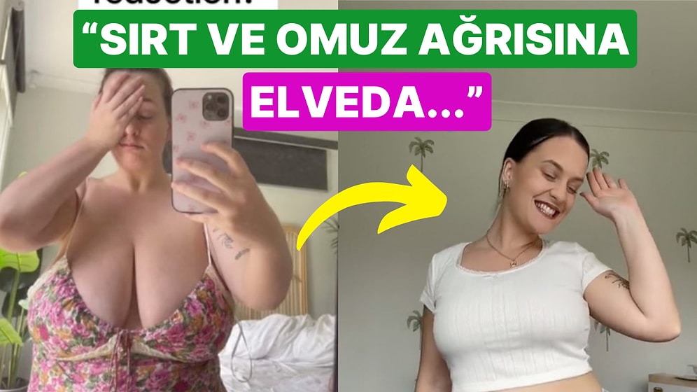 Gitgide Popüler Olmaya Başlayan Meme Küçültme Ameliyatını Niçin Tercih Ettiğini Açıklayan Kadınlar