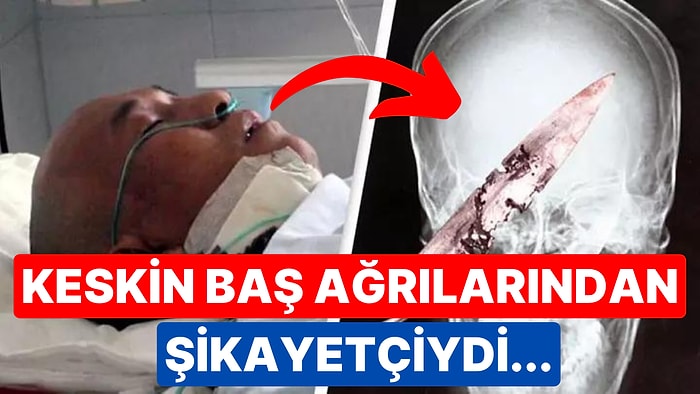 Dört Yıldır Baş Ağrısı Çeken Adamın Kafasında 'Paslı Bıçak' Kaldığı Öğrenildi