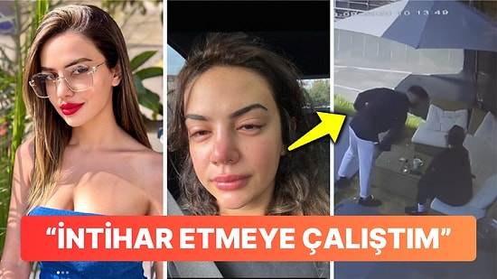 Ece Ronay, Eski Eşi Tarafından Şiddet Gördüğü Anları Paylaştı!