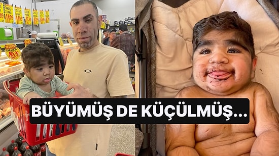 TikTok'ta Yetişkin Erkekler Gibi Saçı Sakalı Olan Bebeğin Videolarını Görenler Gözlerine İnanamadı