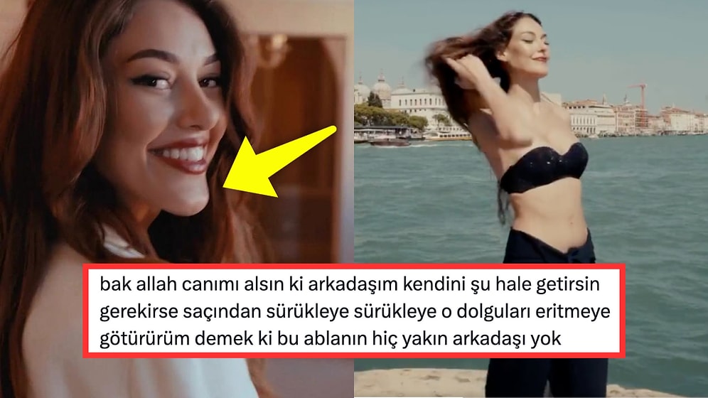 Estetik Müdahelelerle Bambaşka Birine Dönüşen Dilan Çiçek Deniz Çene Dolgusunu Abartınca Olanlar Oldu!