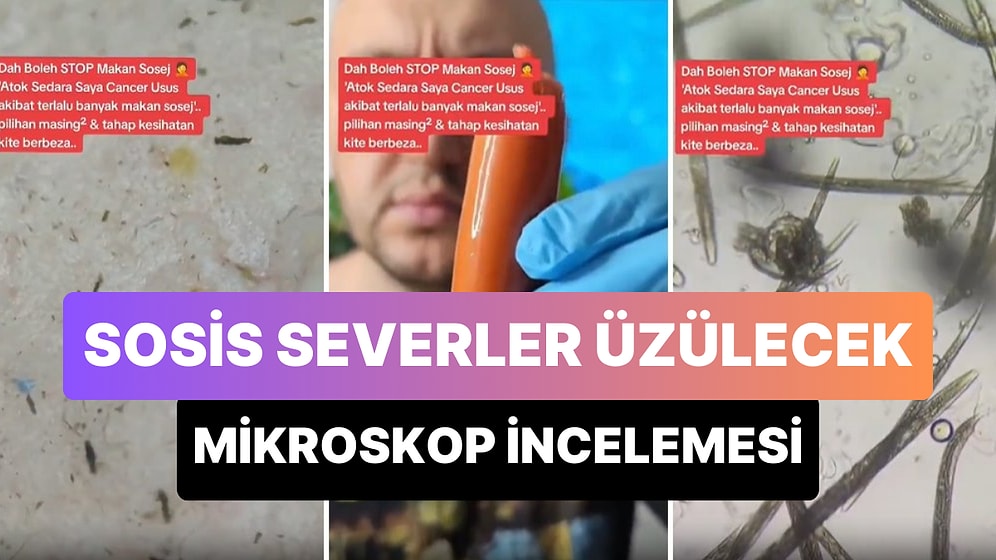 Her Gün Soframıza Konuk Olan Sosisler Mikroskop Altında Nasıl Gözüküyor?