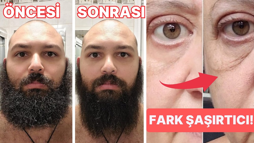 Sonuçları “Harika” Olarak Nitelendirilen Güzellik Ürünleri