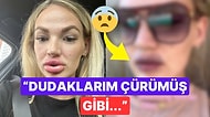 Dudak Botoksunu Eriten Kadının Başına Gelenleri Görünce Estetiğe Tövbeler Edeceksiniz!