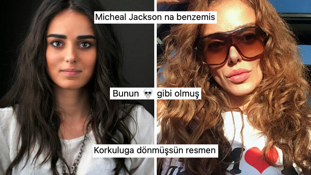 "Estetik Yaptırmadım" Diyen Bestemsu Özdemir'in Yanaklarını Aldırdığı İddia Edildi!