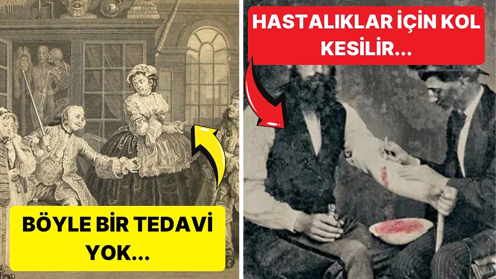 Modern Tıp Gelişmeden Önce Acının İliklere Kadar Hissedildiği Antik Tedavi Yöntemleri