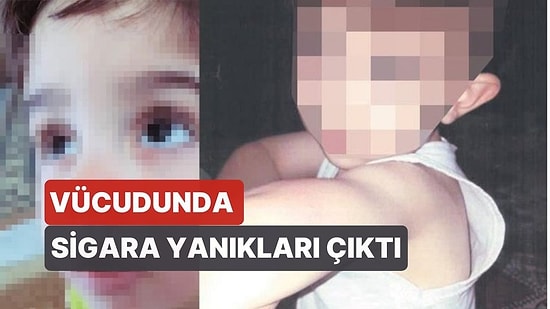 Anneden 4 Yaşındaki Oğluna İşkence! Vücudunda Sigara Yanıkları Çıktı