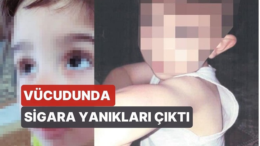 Anneden 4 Yaşındaki Oğluna İşkence! Vücudunda Sigara Yanıkları Çıktı
