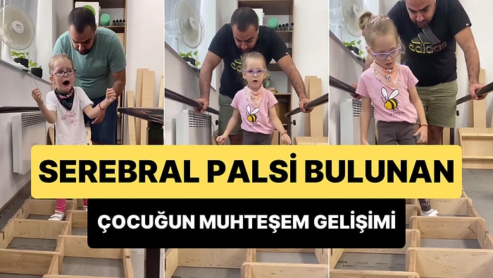 Serebral Palsi Bulunan Çocuğun Azim ve Çalışma ile Zaman İçerisinde Yaşadığı Muhteşem Değişim