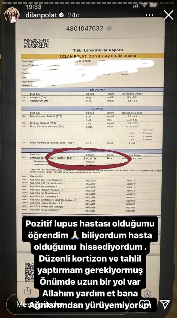 Dilan Polat, bütün bu strese ve iftiralara katlanamadığını söylemişti ve hastanelik olmuştu. Bir gün sonra da tahlil sonuçlarını paylaşarak Lupus hastası olduğunu açıklamıştı 👇