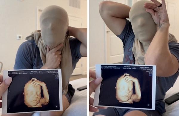 Bir baba da kızının ultrason fotoğrafını görünce heyecana kapıldı.