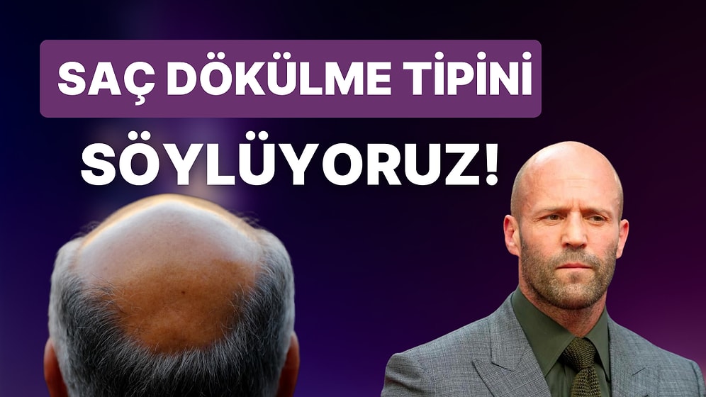 Bize Saçlarını Anlat, Dökülme Tipini Söyleyelim!
