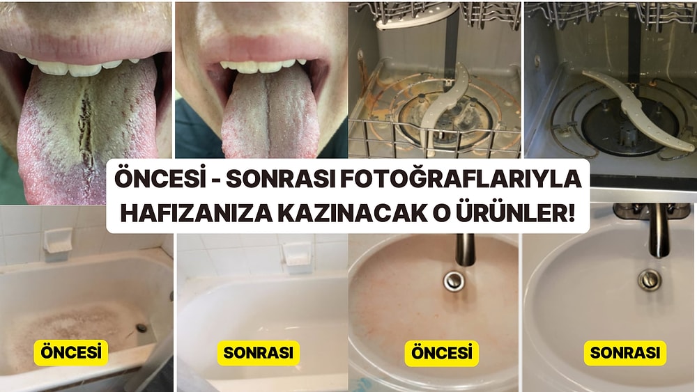 Öncesi - Sonrası Fotoğraflarıyla Gören Herkesi Kullanmaya İkna Eden 13 Ürün