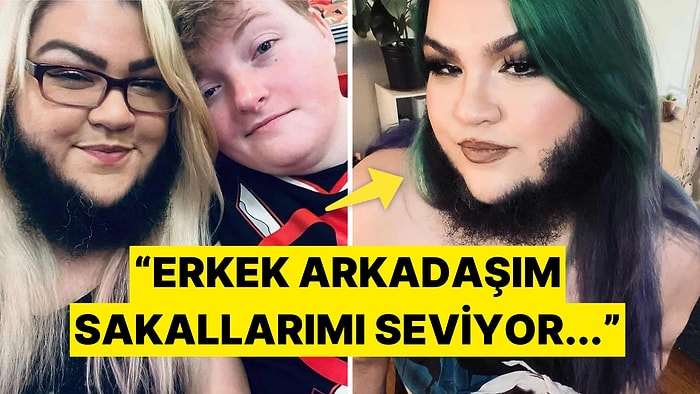 Hastalığı Yüzünden Sakalla Yaşamak Zorunda Kalan Kadından İlginç Açıklamalar