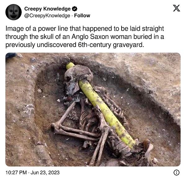 4. "Daha önce keşfedilmemiş bir 6. yüzyıl mezarlığına gömülmüş bir Anglo Sakson kadının kafatasının içinden geçen elektrik hattının görüntüsü."