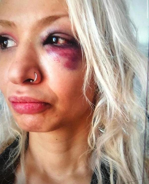 Müzisyen Aybike Çelik, eski sevgilisi Can Tunaboylu'nun kendisine şiddet uyguladığını iddia etmiş; "3 Ağustos gecesi eski erkek arkadaşım olan şahıs tarafından ağır şekilde darp edildim" açıklamasında bulunmuştu.