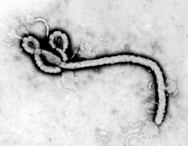 8. Ebola virüsünün ilk çekilmiş görüntüsü. (13 Ekim 1976)