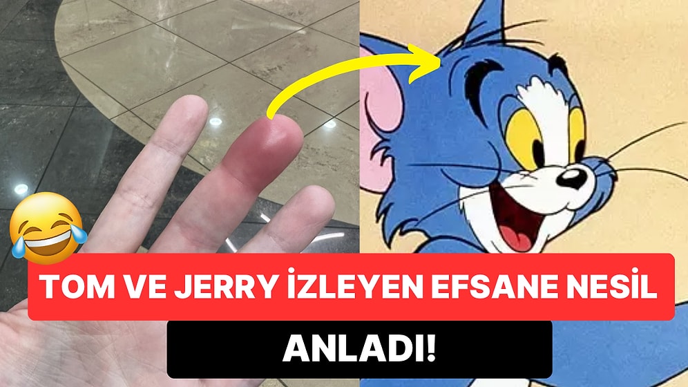 Parmağını Çizgi Filmlerdeki Gibi Yaralayan Twitter Kullanıcısı Goygoycuların Diline Fena Düştü!