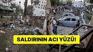 İsrail'in Bombaladığı Hastanedeki Acı Tablo Gün Aydınlanınca Ortaya Çıktı!