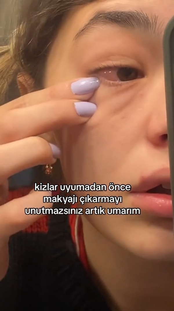 Yağmur Örün adlı TikTok kullanıcısı, makyajını çıkarmadan uyuduğu gecenin sabahında büyük bir şok yaşadı.