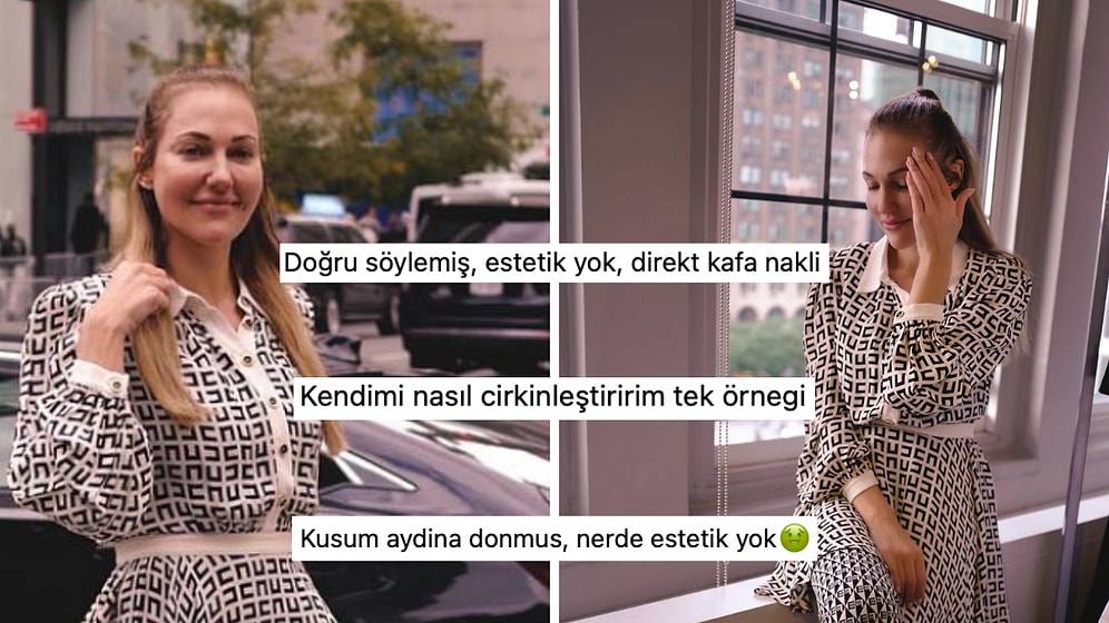 Estetik Yaptırmadığını Söyleyen Meryem Uzerli'nin Son Pozları "Nasıl Estetik Yok?" Dedirtti