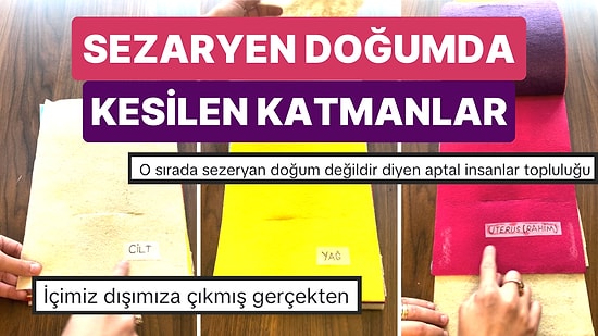 Sosyal Medyada Doğumla İlgili Bilgiler Veren Bir Kullanıcı Sezaryen Doğumda Kesilen Katmanları Gösterdi