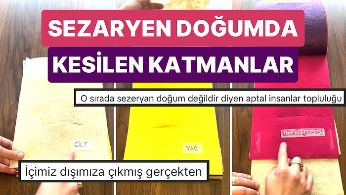 Sosyal Medyada Doğumla İlgili Bilgiler Veren Bir Kullanıcı Sezaryen Doğumda Kesilen Katmanları Gösterdi