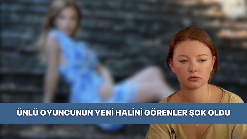 "Adını Feriha Koydum" Dizisinin Oyuncusu Sedef Şahin Estetikleriyle Gündemde