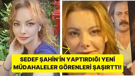 Adını Feriha Koydum'un Cansu'su Sedef Şahin Yaptırdığı Son Müdahale İle Görenleri Şaşırttı!