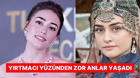 Ünlü Oyuncu Esra Bilgiç'in Talihsiz Anları: Galada Elbisesi Yırtıldı