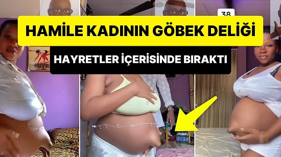 Göbek Deliğindeki Çıkıklık ile Görenleri Hayret İçerisinde Bırakan Hamile Kadın